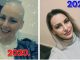 Jasmina prošla 31 zračenje i 16 kemoterapija, danas s ponosom kaže ‘Uspjela sam’