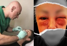 Dr. Siručić o deformisanom Azrinom licu: Bila je informisana o rizicima, otok se trebao sanirati na vrijeme - featured image