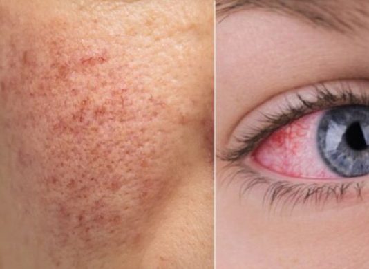 12 ranih znakova da vaše tijelo pokušava reći da vam je JETRA OŠTEĆENA. - featured image