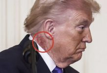 Širi se fotografija crvene mrlje na Trumpovom vratu. Javila se Bijela kuća - featured image