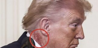 Širi se fotografija crvene mrlje na Trumpovom vratu. Javila se Bijela kuća - featured image